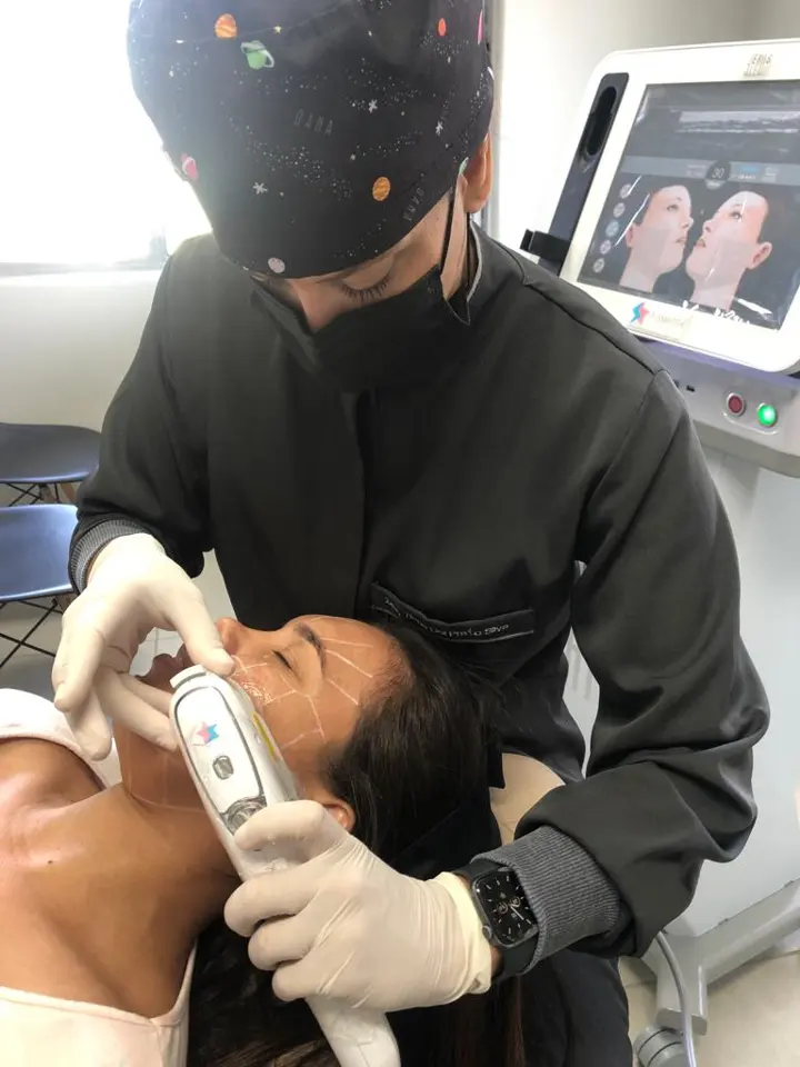 Ultrassom microfocado aplicado no rosto de uma paciente